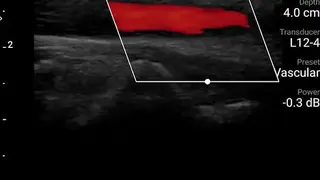 Philips Lumify Ultrasound App screenshot