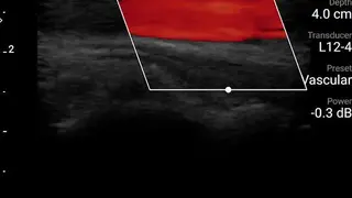Philips Lumify Ultrasound App screenshot