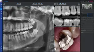 Planmeca Romexis screenshot