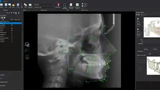 Planmeca Romexis screenshot