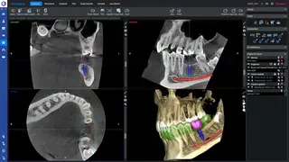 Planmeca Romexis screenshot