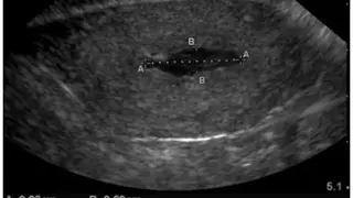 POC Ultrasound Guide screenshot