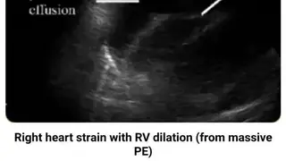 POC Ultrasound Guide screenshot