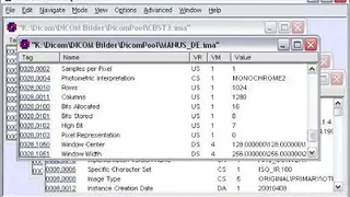 PowerDicom screenshot