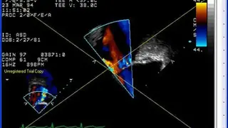 PowerDicom screenshot