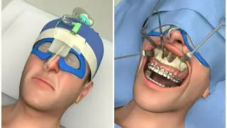 Real Dentist Surgery Simulator screenshot