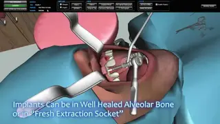 Real Dentist Surgery Simulator screenshot