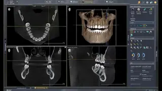 SIDEXIS 4 screenshot