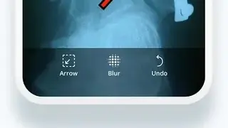 Siilo screenshot