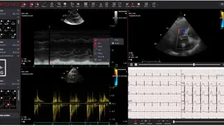 Simplex HIMES screenshot