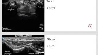 SonoAccess: Ultrasound Education App screenshot