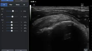 SONON Ultrasound App screenshot