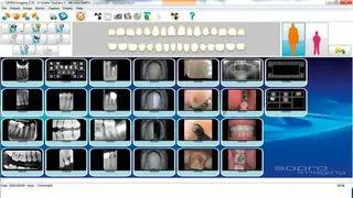 Sopro Imaging screenshot