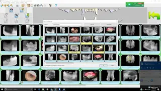 Sopro Imaging screenshot