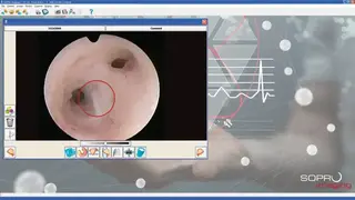 Sopro Imaging screenshot