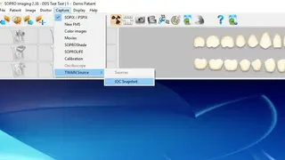 Sopro Imaging screenshot