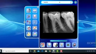 Sopro Imaging screenshot