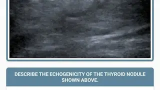 Thyroid Nodules screenshot