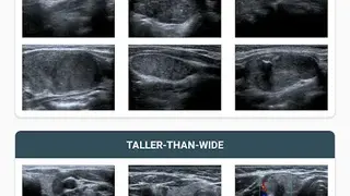 Thyroid Nodules screenshot