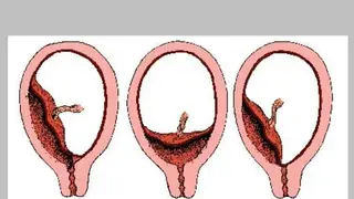 Ultrasound Guide screenshot