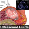 Ultrasound Guide