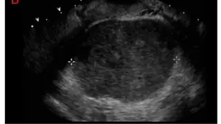 Ultrasound Guide A2Z screenshot