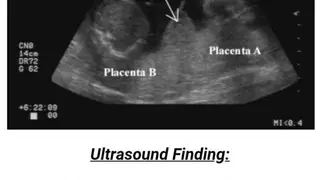 Ultrasound Guide A2Z screenshot