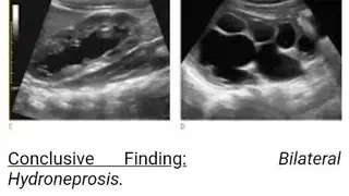 Ultrasound Guide A2Z screenshot