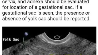 Ultrasound Guide A2Z screenshot