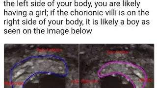 Ultrasound Guide A2Z screenshot