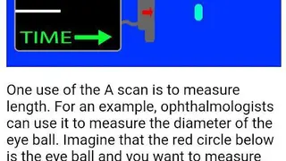 Ultrasound Guide A2Z screenshot