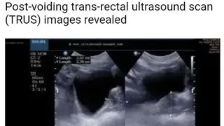 Ultrasound Guide A2Z screenshot