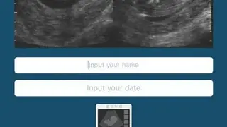Ultrasound Prank Free screenshot