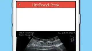 Ultrasound Prank Free screenshot