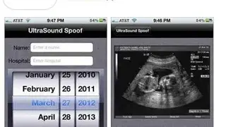 Ultrasound Prank Free screenshot