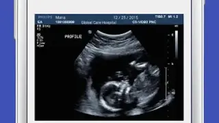 UltraSound Spoof screenshot