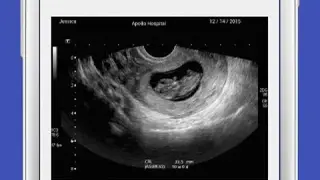 UltraSound Spoof screenshot