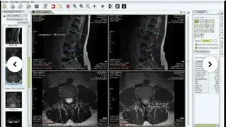 Weasis screenshot