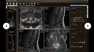 Weasis screenshot