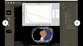 Weasis screenshot