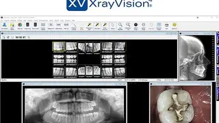 XrayVision screenshot