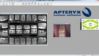 XrayVision screenshot