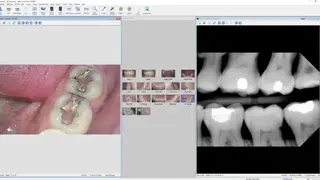 XrayVision screenshot