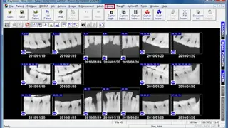 XrayVision screenshot